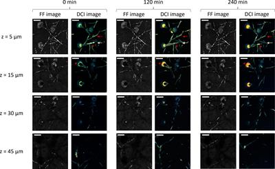 Dynamic full-field optical coherence tomography for live-cell imaging and growth-phase monitoring in Aspergillus fumigatus